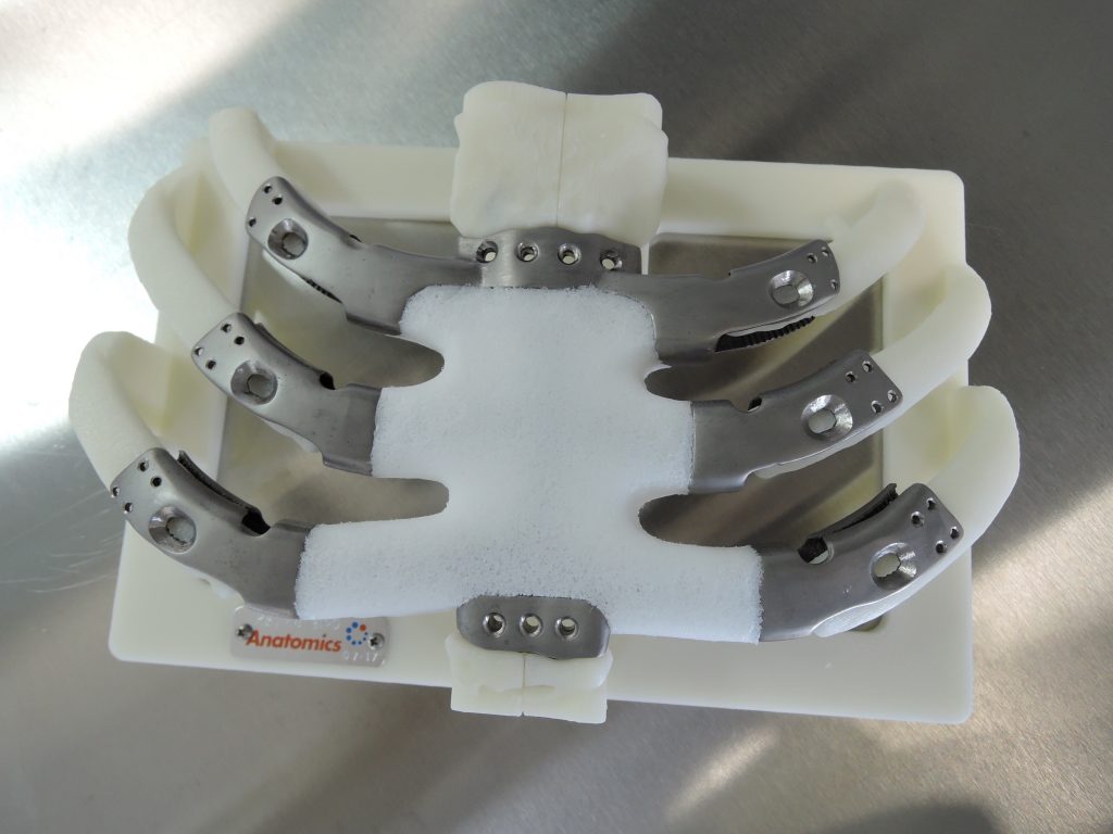 New-York-2017-3D-printed-implant-as-shipped-on-its-mount-1024×768