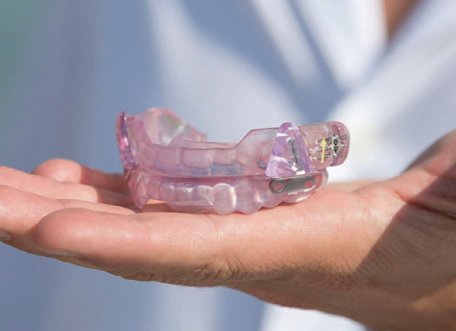 OralAppliance