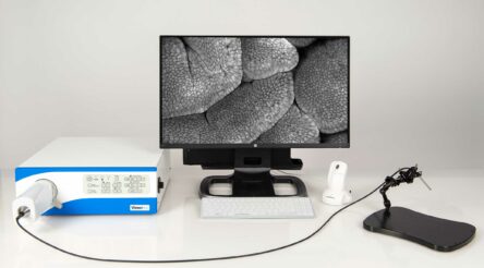 Image for Optiscan Imaging in new Melbourne oral cancer trial