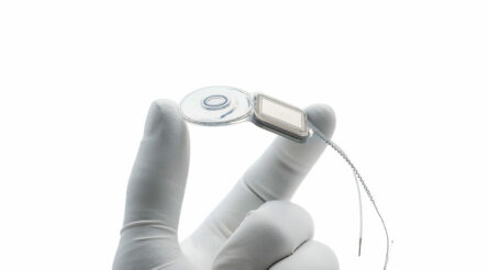 Image for Sales growth drives Cochlear recovery