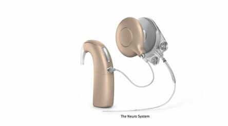 Image for Cochlear buys hearing implant rival Oticon Medical