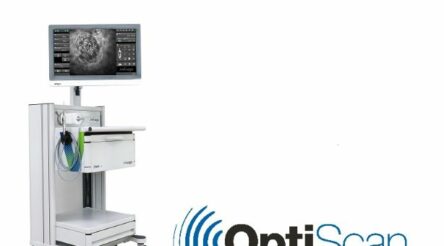 Image for Optiscan Imaging to market InVivage imaging device