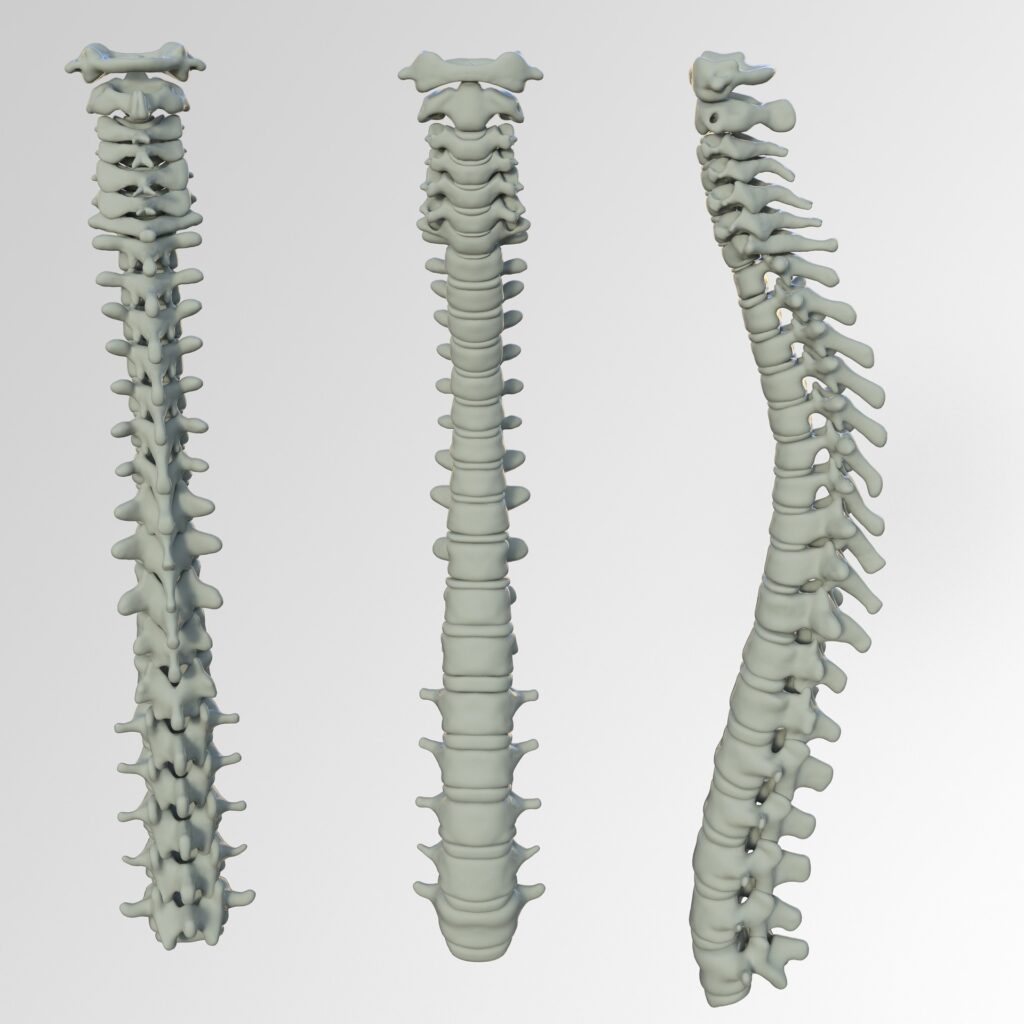 graphic of spines