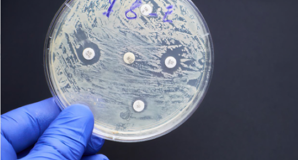 Boost commercialisation to beat microbes - report