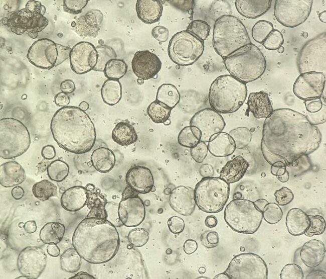 Organoids_1