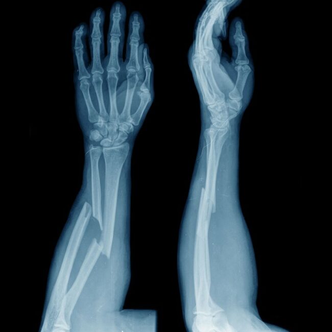 shutterstock_238132441-edit