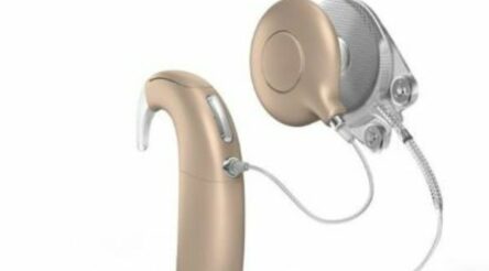 Image for Cochlear completes takeover of Oticon Medical implant business