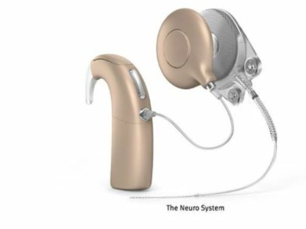 Cochlear completes takeover of Oticon Medical implant business