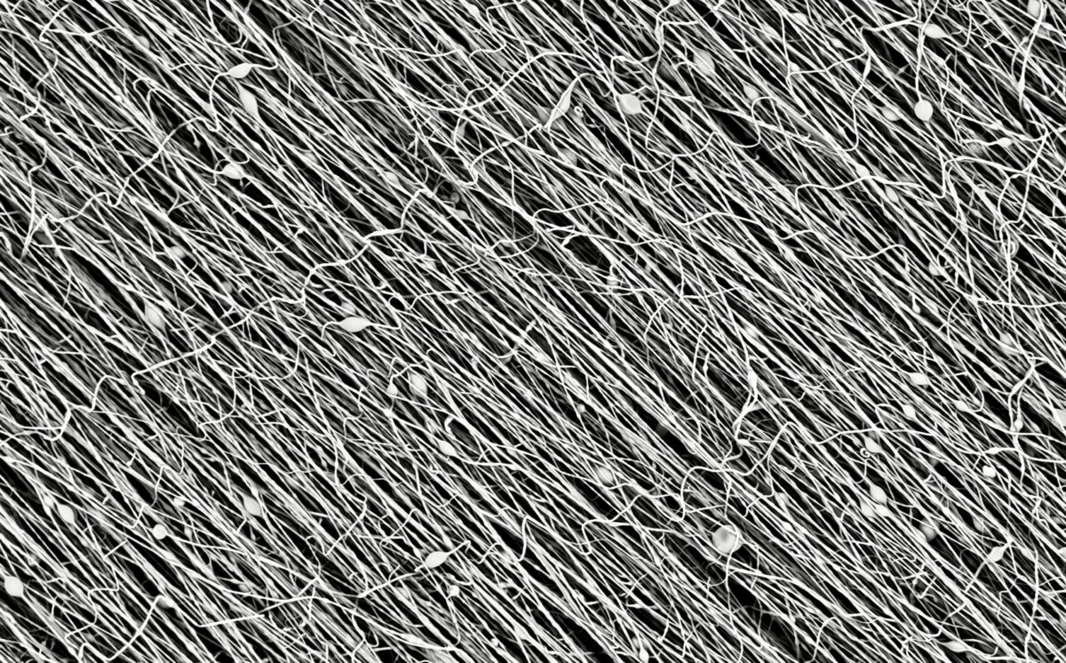 Nanofiber 2 smaller