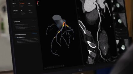 Image for Artrya raises $15 million