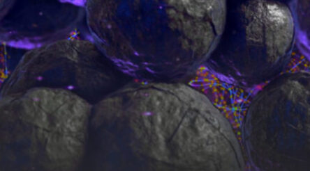 Image for AnteoTech targets high-value medical device market with Wyon’s trial of Ultranode
